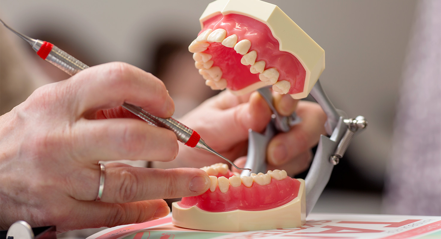 En närbild på en hand som undersöker tänder i en
tandmodell.